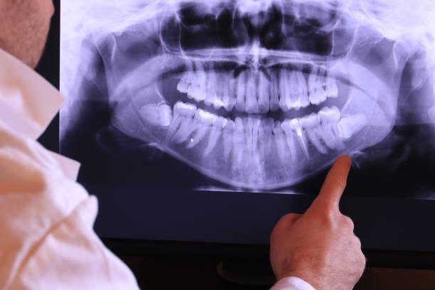 Best Emergency Broken Tooth Repair in Gordon, GA