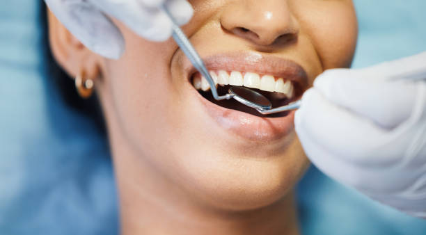 Best Emergency Root Canal Treatment in Gordon, GA